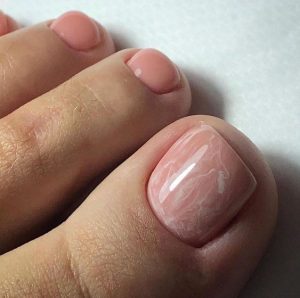 UNHAS PÉS