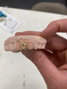 grillz