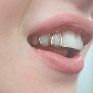 grillz