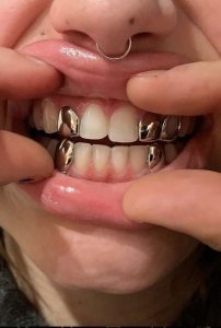 grillz6