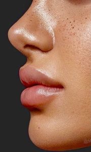 labio