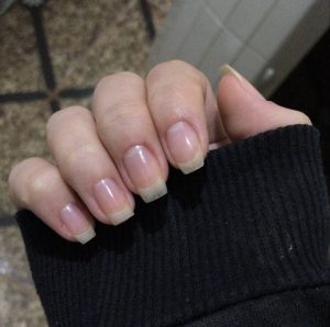 base de tratamento