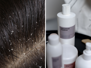 melhores-shampoos-anticaspa-1024x768